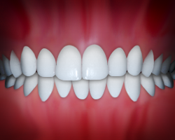 _DentalMidlinesnotMatched